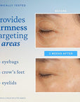 belif Peptide Eye Bomb, Anti-Aging Eye Cream for Wrinkles, Fine Lines, Crow’s Feet & Eye Bags, 48hr Hydration with Ceramide, Squalane, Caffeine, Dermatologist-Tested Korean Skincare, 0.84 fl.oz