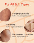 Nature Spell Stretch Mark Oil For Women, Vegan Body Oil for Stretch Marks, Scars & Uneven Skin Tone, 3.38 Fl Oz
