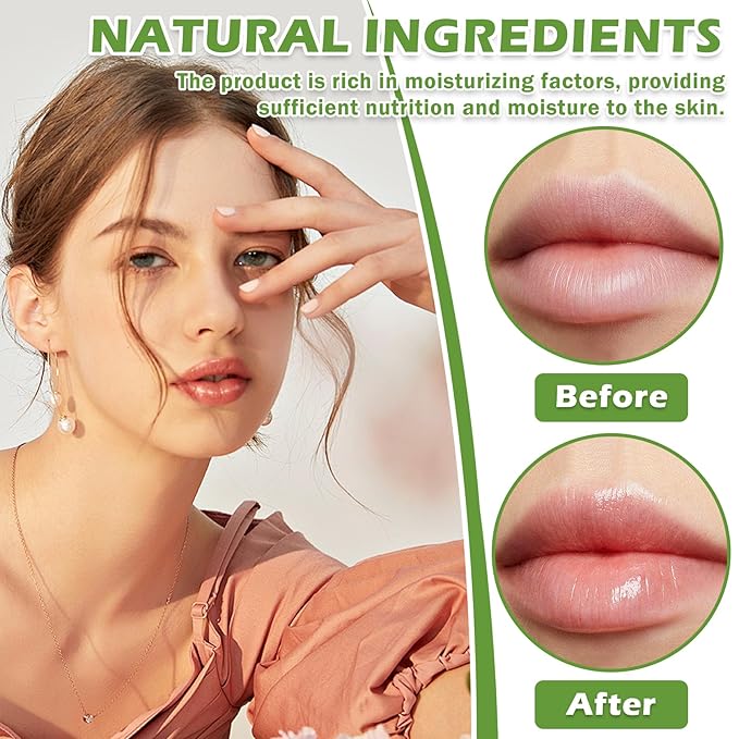 Honey Pot Lip Balm,3PCS Bee Lip (Honey+Apple+Cherry)