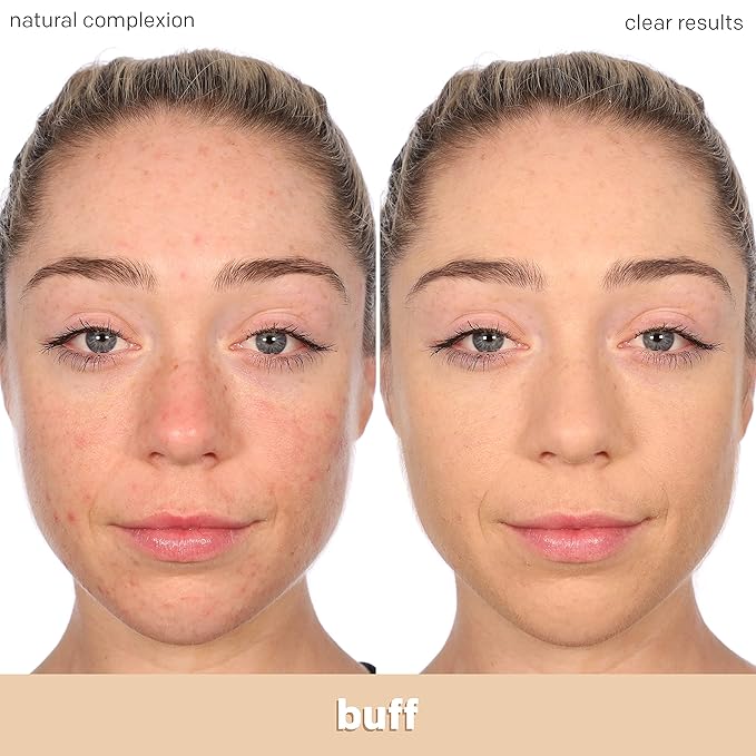 Almay Clear Complexion Acne Foundation Makeup with Salicylic fl oz.