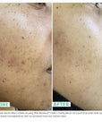Urban Skin Rx, Acne & Dark Cleansing