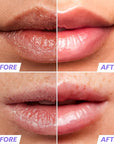 Wonderskin Lip Oil - Lip Rehab Serum Oil, Hydrating and Moisturizing Clear Serum for Dry Lips - Natural, Vegan and Non-sticky (Clear)