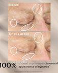 StriVectin Anti-Wrinkle Intensive Eye Cream Concentrate for Wrinkles PLUS, Targets Crow's Feet, Firmness, Puffiness and Dark Circles, 1 Fl oz