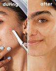 Gillette Venus Dermaplaning Tool, 2 Blade Refills, Exfoliating Face Razors for Women, Eyebrow and Facial Dermaplane Razor