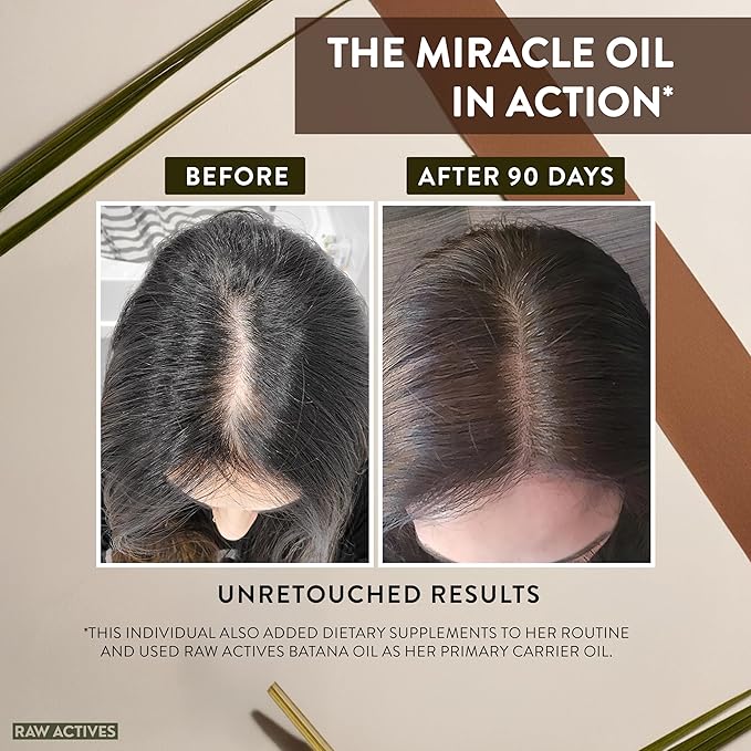 Batana Oil for Hair Growth - 2oz - 100% Pure, Cold Pressed, Unrefined Oil from Honduras - Supports Stronger & Thicker Hair - Dr Sebi Inspired Hair Growth Treatment