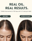 Batana Oil for Hair Growth - 4oz - 100% Pure, Cold Pressed, Unrefined Oil from Honduras - Supports Stronger & Thicker Hair - Dr Sebi Inspired Hair Growth Treatment