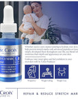 Stretch Mark Serum - Prevent and Reduce Appearance of Stretch Marks - 1 oz