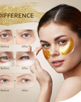 Under Eye Patches (30 Pairs), 24K Gold Under Eye Mask for Puffy Eyes, Dark Circles,Bags and Wrinkles with Collagen,Relieves Pressure and Reduces Wrinkles,Revitalises and Refreshes Your Skin