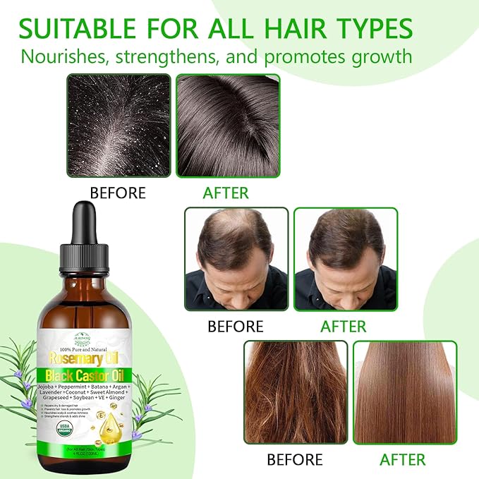 Rosemary & Castor Hair Growth Oil – USDA Certified Organic Cold Pressed Blend Castor oil for Thicker, Fuller Hair, Soothe Itchy Scalp & Repair Damaged Hair – 4 fl oz