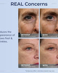 Plexaderm Rapid Reduction Eye Serum - Visibly Reduces Under-Eye Bags, Wrinkles, Dark Circles, Fine Lines & Crow's Feet Instantly, Anti Aging Wrinkle Remover for Face, Pump