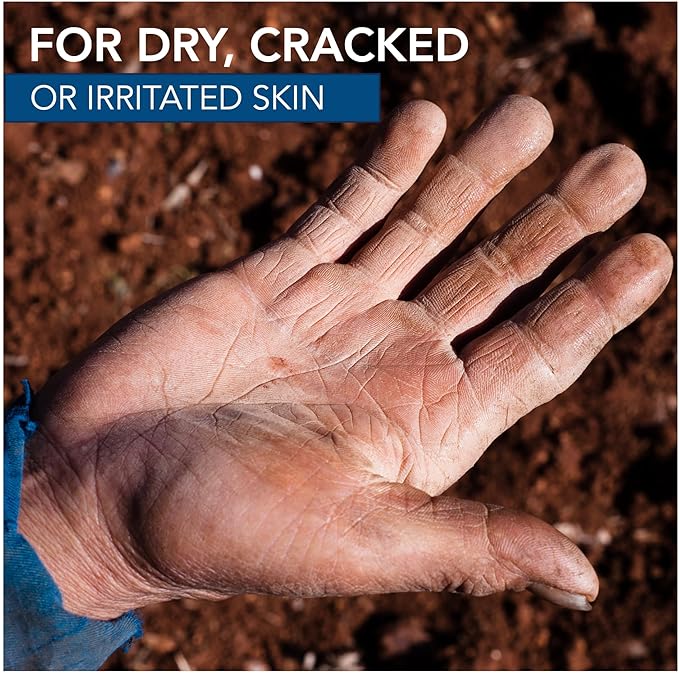 Dermatone Camphor Ice | Skin Balm for Dry, Cracked and Chapped Skin | Lips, Hands, Feet | Skin Irritation Relief | Sunburn | Bug Bites | Minor Burns | Soothing Vapors | Nasal Congestion, 1 oz stick