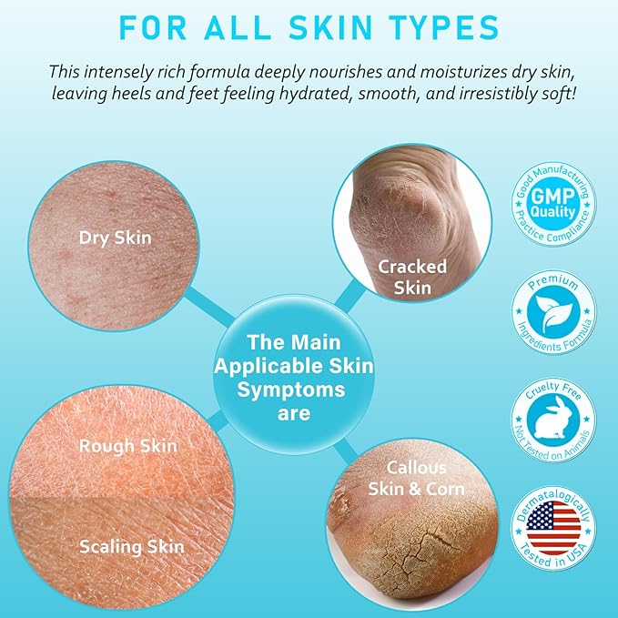Urea Cream 40 Percent For Feet Maximum Strength - plus Salicylic Acid 2% Foot Cream For Dry Cracked Heels Feet Knees - Dead Skin Cuticle Callus Remover Toenail Softener