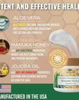 Manuka Honey Eczema Cream Moisturizing Lotion Fragrance Free For Psoriasis Relief - Itchy, Dry Skin Rash Ointment - Skin Soothing Moisturizer - Body & Face Cream - Kids & Adults 2oz