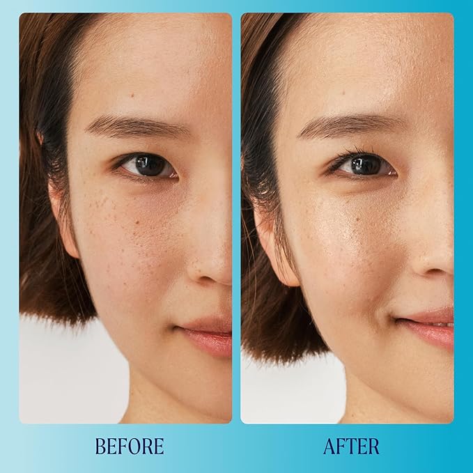 Kinship Supermello Hyaluronic Gel Cream Moisturizer – Hyaluronic Acid Face Lotion – Lightweight + Hydrating – Plump, Smooth + Soothe – Nourish Dry Skin – Rich Daily Use Clean Skin Care (3.3 oz)