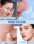 Pimple Patches for Face, 4 Size 360 Counts Hydrocolloid Acne Patches for Covering Zits and Blemishes, Spot Stickers with Salicylic Acid, Tea Tree Oil & Calendula Oil, Mini Package