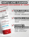THAYERS Blemish Clearing Face Cleanser with 1.5% Salicylic Acid, Acne Treatment Face Wash, Soothing and Non-Stripping Skin Care, 4.4 Fl Oz