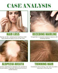 100% Pure Organic Rosemary Essential Oil for Hair Growth - Multi-Purpose Hair Treatment Oil Promotes Eyelash & Eyebrow Growth, 2.02fl oz (Small, Rosemary)