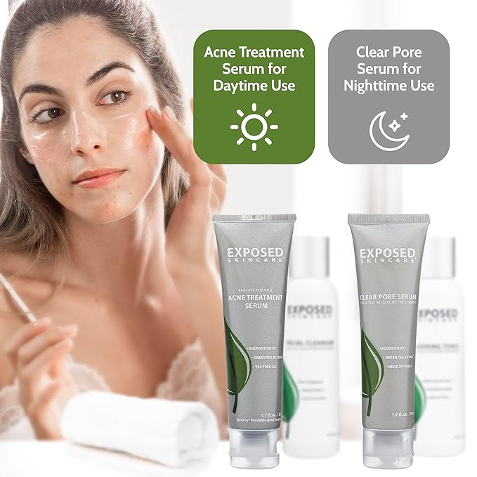 Exposed Skin Care Basic Acne Treatment Clearing