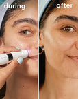 Gillette Venus Mini Facial Hair Remover for Women's Face, Portable Electric Shaver/Razor, Hair Removal for Women, Dermaplaning Tool, Trimmer