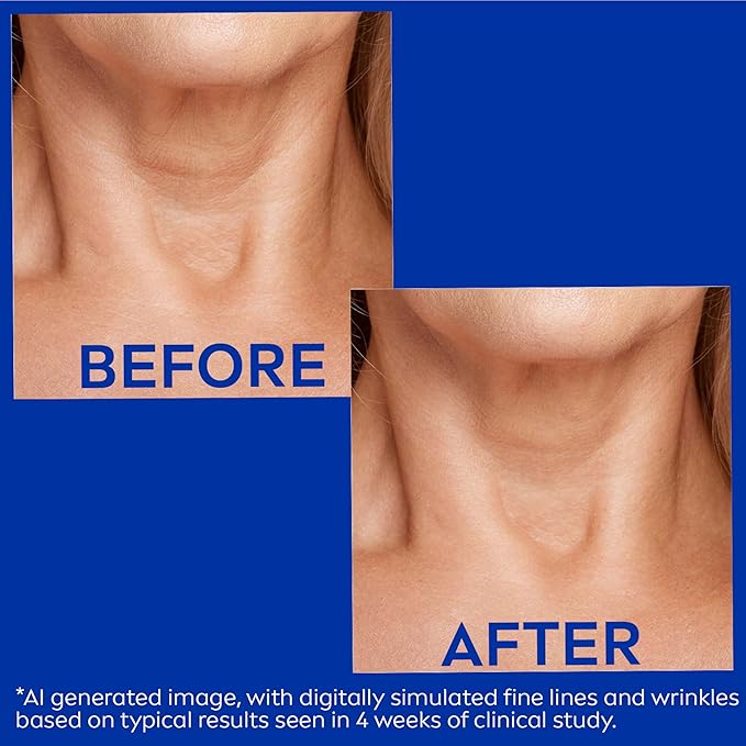 Nivea Skin Firming and Anti Wrinkle Neck and Chest Cream with Q10, Creatine and Provitamin B5, Skin Firming Body Cream Reduces the Look of Fine Lines and Wrinkles, 6.7 Oz Tube