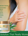 Manuka Honey Eczema Cream Moisturizing Lotion Treatment For Psoriasis Relief - Itchy, Dry Skin Rash Ointment -Skin Soothing Moisturizer Baby Kids & Adults -High Strength Body & Face Cream 8oz