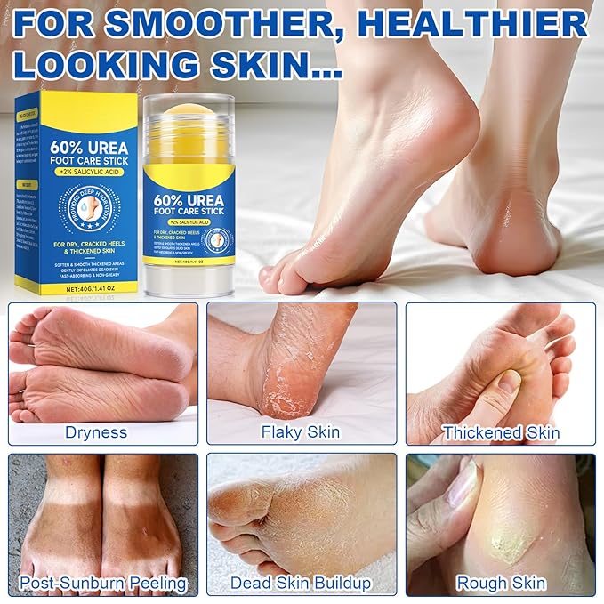Urea Cream 60% Plus Salicylic Acid 2% Foot Balm Stick for Dry Cracked/Chapped Heel, Skinned knees, Hand Intensively Hydration & Moisturization, Callus Removal & Softening, Soothing|1.41 Oz/40 G