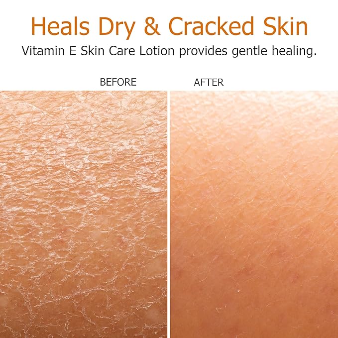 Fruit of the Earth Vitamin E Lotion 16 oz (2 Pack)