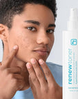 BRIOTECH Renew Toner, Hypochlorous Acid Spray, Minimize Appearance of Blemishes, Soothing Facial Mist for Sensitive Skin, Calm Redness & Bumps, Hypoallergenic & Vegan, 2 fl oz Travel Size (2)