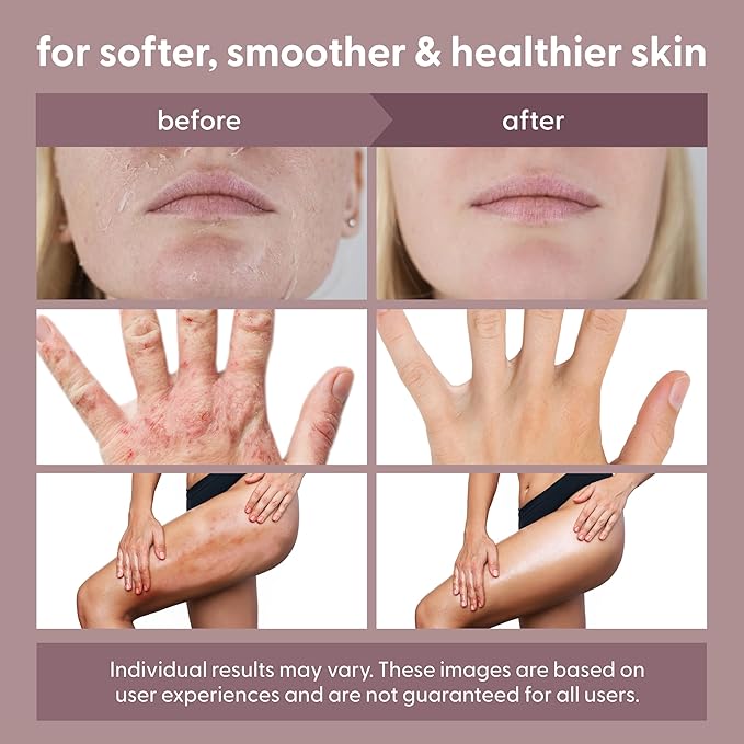 100% Grass Fed Beef Tallow for Skin, Body and Face | Moisturizing Honey Balm Scented with Cinnamon, Rosemary, Peppermint and Clove Bud Essential Oils | Suitable For Dry & Irritated Skin, 2 oz (57g)