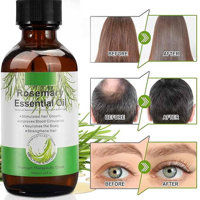 Rosemary Oil for Hair Growth, 100% Natural Cold Pressed Rosemary Hair Oil, Multipurpose Rosemary Essential Oils for Skin, Aromatherapy for Women & Men