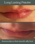 Doctor Rogers Lip Balm. Hydrating & Softening Lip Moisturizer for Very Dry Lips, Natural & Hypoallergenic, 0.15 Ounce (4.25 g) Tube