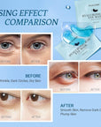 Under Eye Patchs Hyaluronic Acid Eye Mask for Dark Circles and Puffiness Wrinkle Eye Bags 30 Pairs