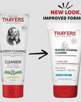 THAYERS Blemish Clearing Face Cleanser with 1.5% Salicylic Acid, Acne Treatment Face Wash, Soothing and Non-Stripping Skin Care, 4.4 Fl Oz