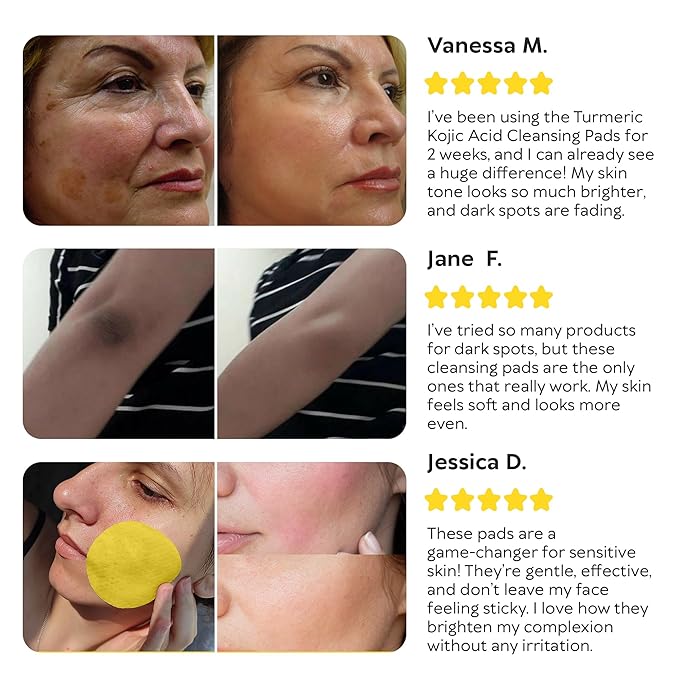 Turmeric Kojic Acid Cleansing Pads - Exfoliating Turmeric Pads for Face Dark Spots, Discoloration - Daily Skin Care for Men & Women - Natural Glow Facial Wash