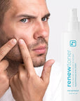 BRIOTECH Skin Renew Toner, Hypochlorous Acid Spray Topical Skin Spray for Face and Skin, Minimize Appearance of Blemishes, Soothing Mist for Redness & Bumps, 4 fl oz ea, 4 ct
