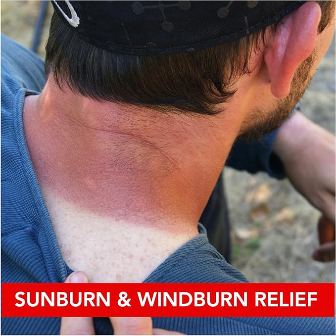 Dermatone Camphor Ice | Skin Balm for Dry, Cracked and Chapped Skin | Lips, Hands, Feet | Skin Irritation Relief | Sunburn | Bug Bites | Minor Burns | Soothing Vapors | Nasal Congestion, 1 oz stick