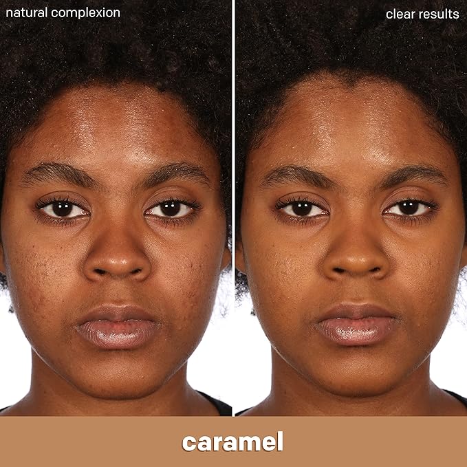 Almay Clear Complexion Acne Foundation Makeup with Salicylic fl oz.