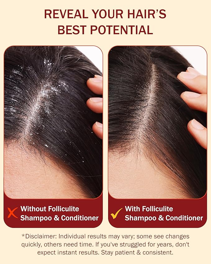 3% BHA Folliculitis Shampoo and Conditioner for Women & Men - Made with Salicylic Acid & Tea Tree Oil - Flakes Shampoo & Deep Conditioner for Dry Itchy Scalp & Acne by e70