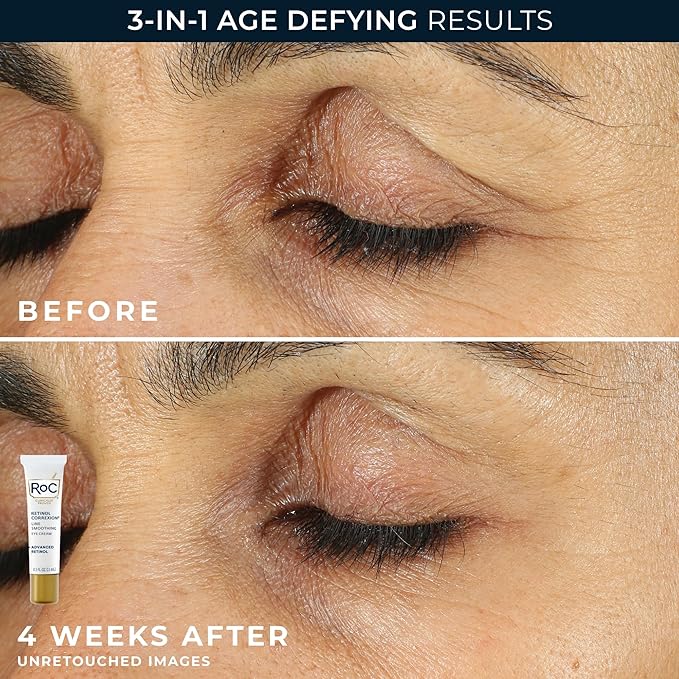 RoC Retinol Correxion Value Set Duo, Deep Wrinkle Anti-Aging Night Face Cream + Daily Under Eye Cream for Dark Circles & Puffiness , Skin Care Set (Packaging May Vary)