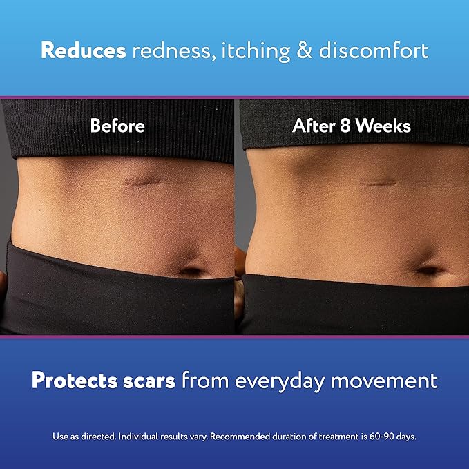 ScarAway Silicone Scar Gel, Helps Improve 20g