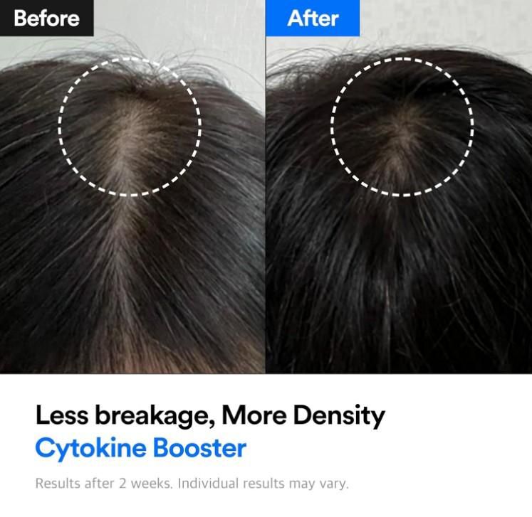 Refilled Hair Recovery Cyrokine Booster 100ml