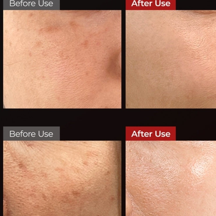 Dr.Melaxin Astaxanthin Anti-Freckles & Whitening Capsule Cream 50ml