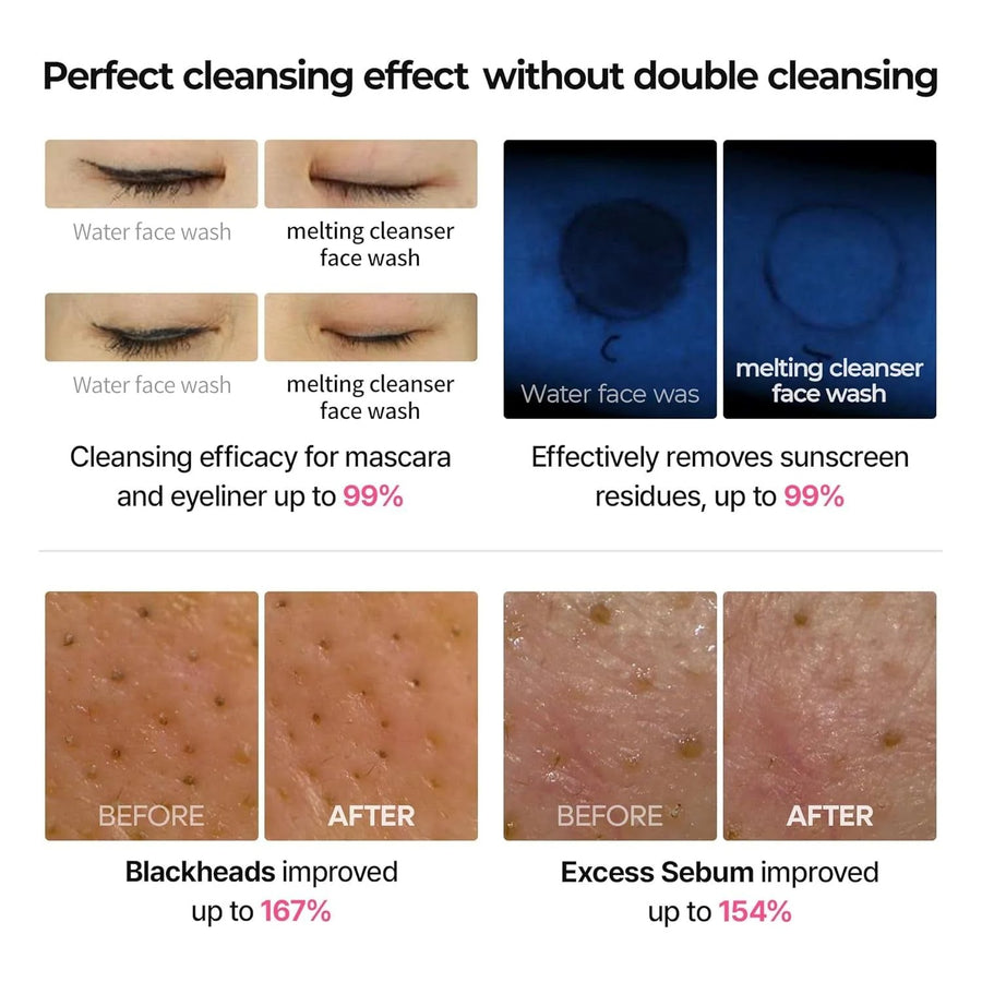 Dr.Melaxin Blubble Foaming Melting Cleanser 150ml