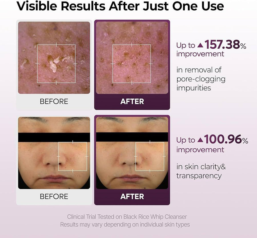 Dr.Melaxin Peel Shot Black Rice Whip Cleanser 100ml