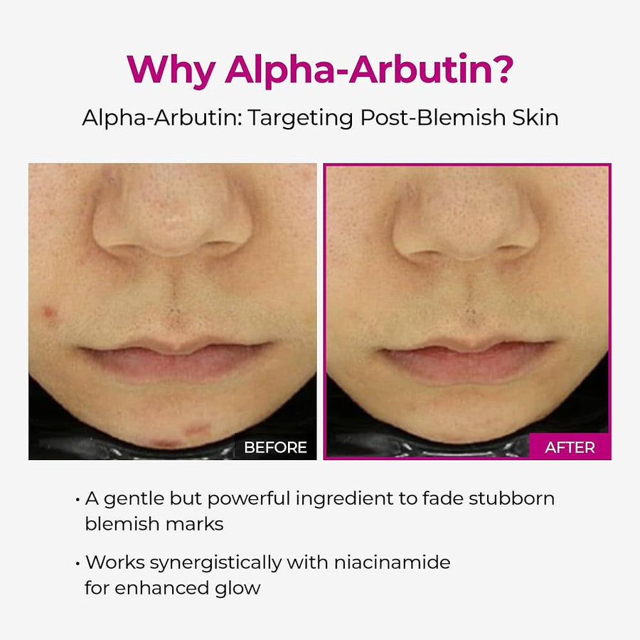 Dr.Melaxin Cemenrete Picotonic Shot Pigmentation Corrector Calcium Ampoule 30ml