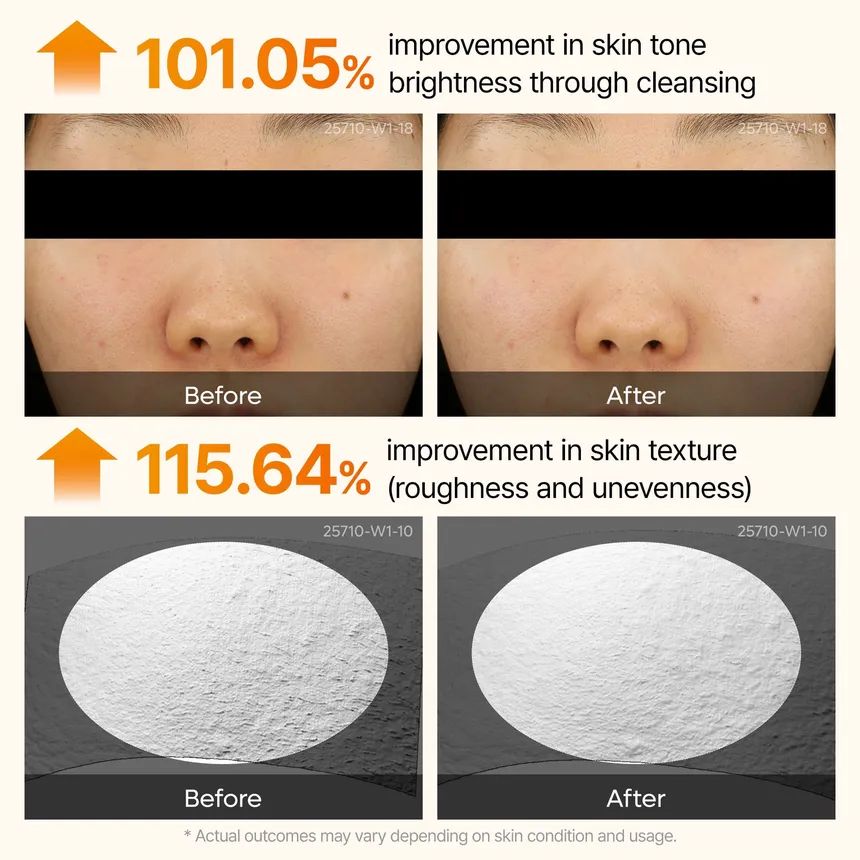 Dr.Melaxin Peel Shot Exfoliating Kojic Acid Turmeric Serum 80ml