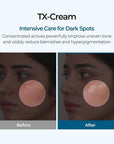 Dr.Melaxin TX Melasma Cream 50ml