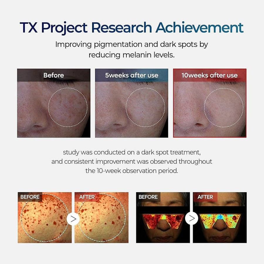 Dr.Melaxin TX Melasma Cream 50ml