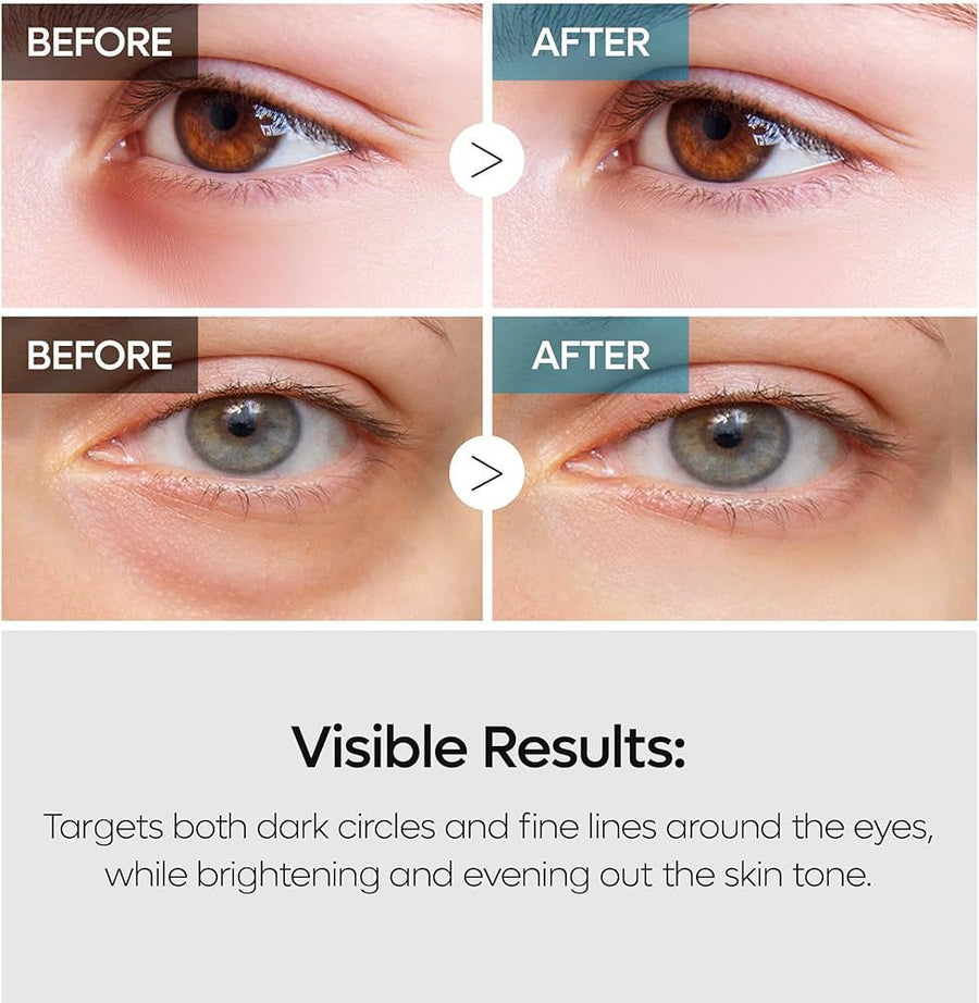 Dr.Melaxin TX-Retinalsome Double Effect Eye Cream 40g