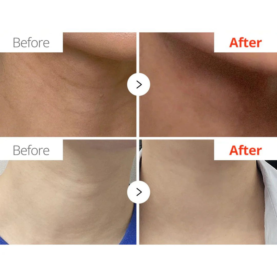 Dr.Melaxin Necksphalt ECM Ceramide Neck Cream 50ml